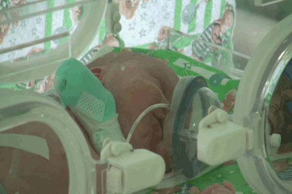 В Лисичанскую больницу доставили новорожденную девочку, которую горе-мать выбросила в Станице-Луганской