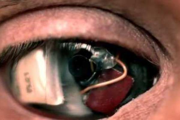 Режиссер Роб Спенсер установил камеру вместо удаленного глаза