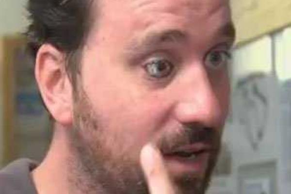 Режиссер Роб Спенсер установил камеру вместо удаленного глаза