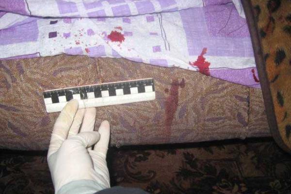 В Ровно мужчина случайно выстрелил себе в голову из газового оружия В Ровно мужчина случайно выстрелил себе в голову из газового оружия