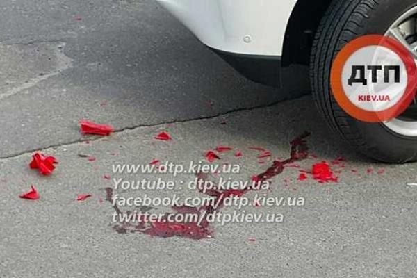 В Киеве женщина на внедорожнике "Lexus" переехала 4-летнего ребенка. 18+ В Киеве женщина на внедорожнике "Lexus" переехала 4-летнего ребенка. 18+