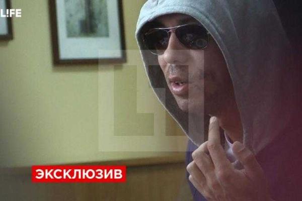 Актер Алексей Панин попал в аварию и получил серьезные травмы лица