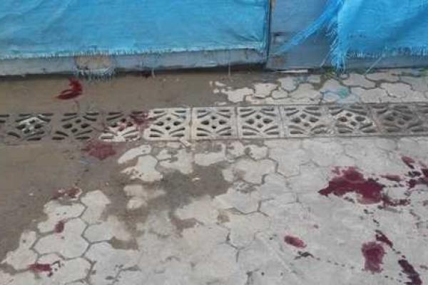 Депутаты открыли стрельбу в ресторане Ужгорода: ранен человек