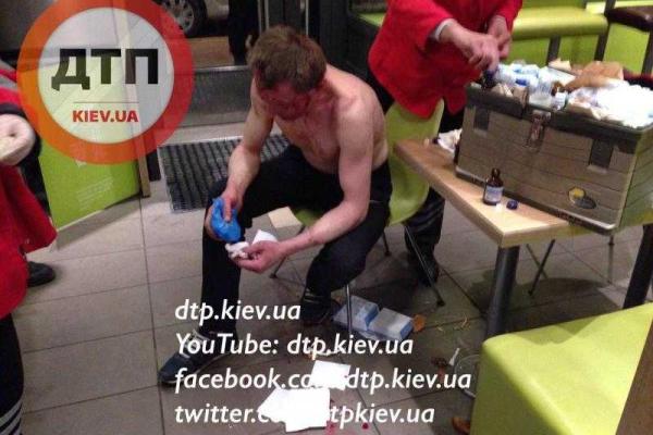 В Киеве окрававленный мужчина вырвался из автомобиля "Mercedes", в котором его хотели убить