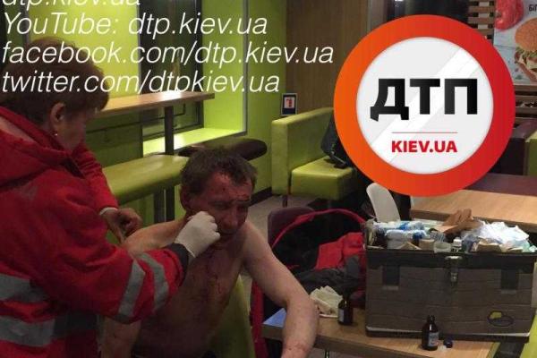 В Киеве окрававленный мужчина вырвался из автомобиля "Mercedes", в котором его хотели убить