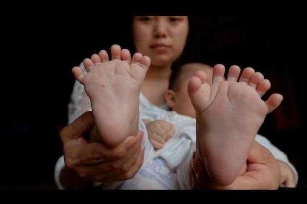 В Китае родился необычный ребенок