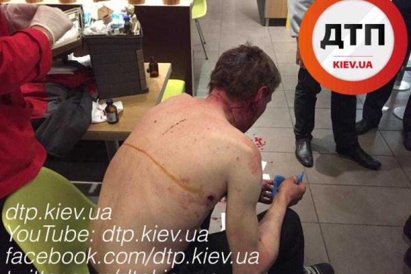 В Киеве окрававленный мужчина вырвался из автомобиля "Mercedes", в котором его хотели убить