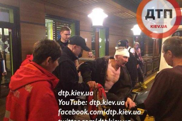 В Киеве окрававленный мужчина вырвался из автомобиля "Mercedes", в котором его хотели убить