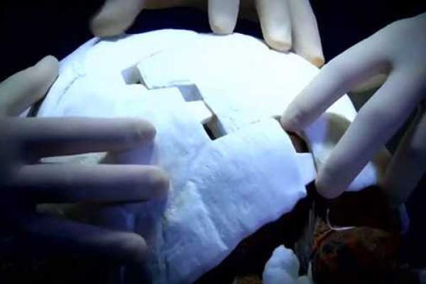 В Бразилии пострадавшая в огне черепаха получила новый панцирь, напечатанный на 3D-принтере В Бразилии пострадавшая в огне черепаха получила новый панцирь, напечатанный на 3D-принтере