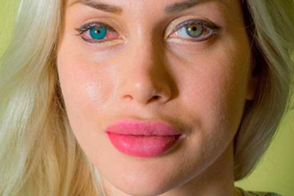 Модель Пикси Фокс продолжает шокирующие эксперименты с внешностью, чтобы стать похожей на куклу