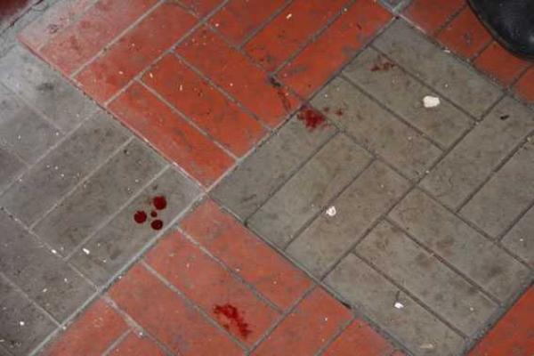 На Черниговщине метнули гранату в толпу молодежи возле клуба: есть раненые На Черниговщине метнули гранату в толпу молодежи возле клуба: есть раненые