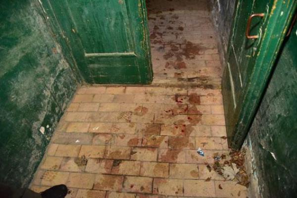 Стали известны подробности ранения мирного жителя во время ночного обстрела Красногоровки Стали известны подробности ранения мирного жителя во время ночного обстрела Красногоровки