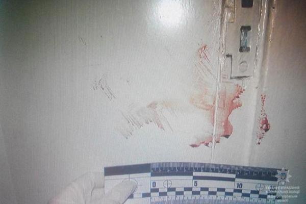 На Днепропетровщине подростки едва не убили школьника из-за компьютера: мальчик в реанимации На Днепропетровщине подростки едва не убили школьника из-за компьютера: мальчик в реанимации