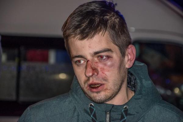 В Киеве сотрудники пиццерии избили ночных посетителей В Киеве сотрудники пиццерии избили ночных посетителей