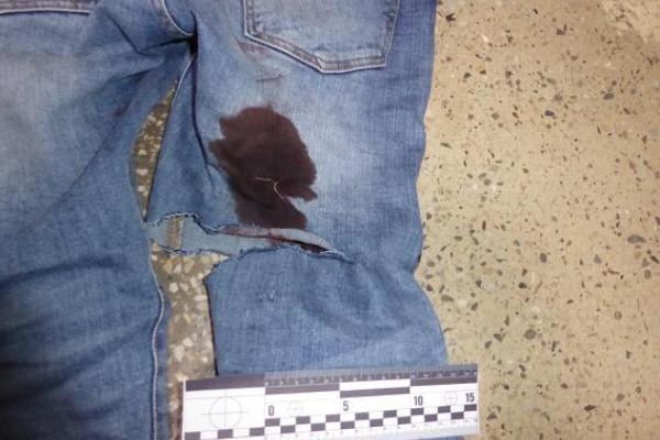 В Киеве конфликт в автобусе перерос в кровавую расправу над мужчиной В Киеве конфликт в автобусе перерос в кровавую расправу над мужчиной
