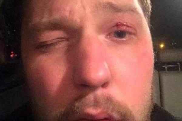 Адвокат Корбана попал в ДТП, - фотофакт Адвокат Корбана попал в ДТП, - фотофакт