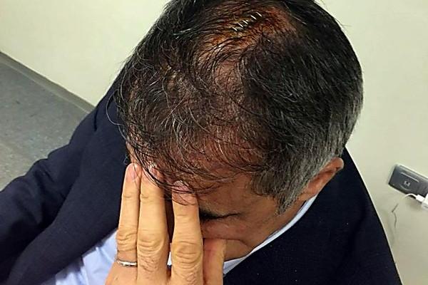 Тренеру "Бешикташа" фанаты "Фенербахче" разбили голову, опубликовано видео