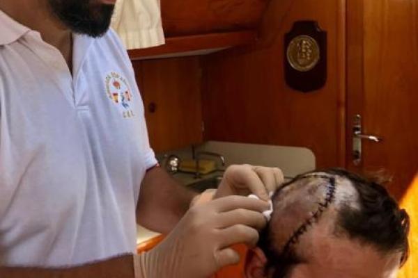 Испанский матадор чуть не лишился головы: на видео засняли, как бык содрал часть скальпа с мужчины