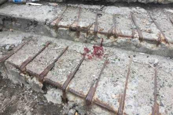 Девушка, выстрелившая себе в голову в Киеве, могла сделать это случайно 