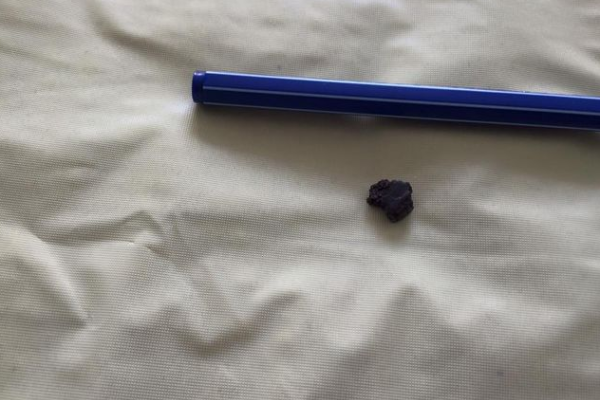 Раненый экс-министр молодежи и спорта опубликовал фото после операции