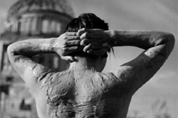 Ужасные кадры бомбардировки Хиросимы и Нагасаки (18+)
