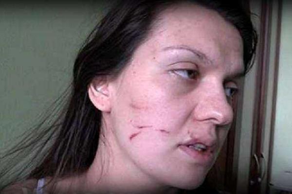 Беременную беженку из Донбасса избили в элитной московской клинике Беременную беженку из Донбасса избили в элитной московской клинике