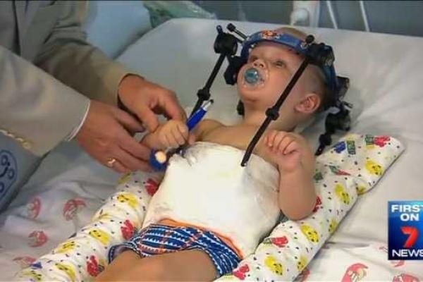 Австралийские медики спасли ребенка после внутреннего обезглавливания