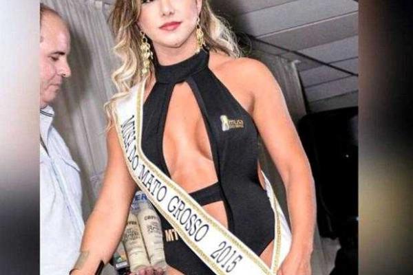 Знаменитая 28-летняя модель умерла во время пластической операции