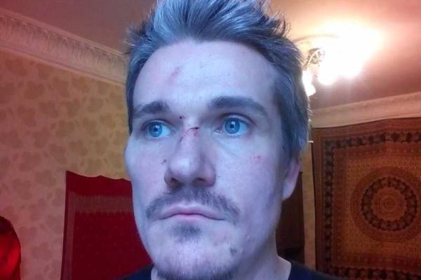 В Одессе неизвестные избили активистов ЛГБТ-сообщества В Одессе неизвестные избили активистов ЛГБТ-сообщества