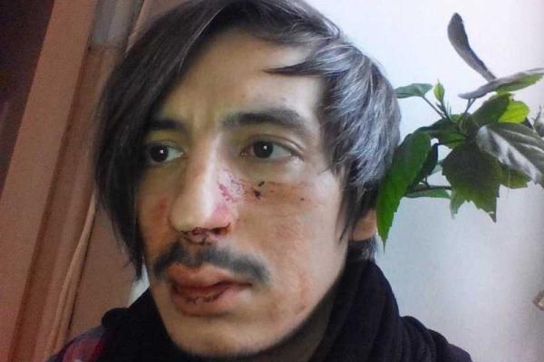 В Одессе неизвестные избили активистов ЛГБТ-сообщества В Одессе неизвестные избили активистов ЛГБТ-сообщества