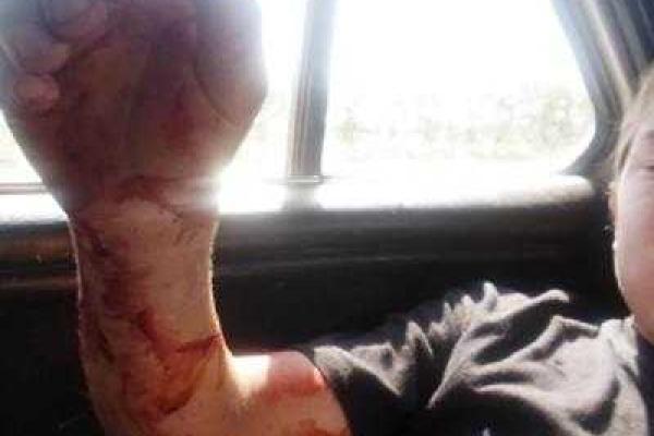 В Горловке будут принимать «радикальные меры» по борьбе с бездомными животными В Горловке будут принимать «радикальные меры» по борьбе с бездомными животными