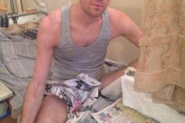 Стало известно, какое пособие получают покалеченные боевики "ДНР"