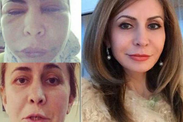 Звезда "Дома-2" Ирина Агибалова рассказала жуткую правду о пластических операциях Звезда "Дома-2" Ирина Агибалова рассказала жуткую правду о пластических операциях