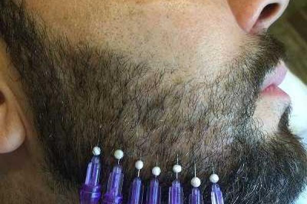 Певец Денис Клявер шокировал снимком из кабинета косметолога