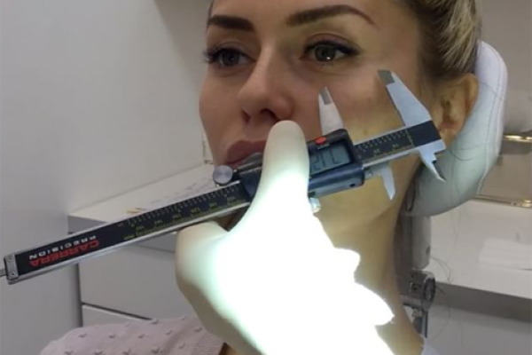 Телеведущая Виктория Боня шокировала результатом пластики