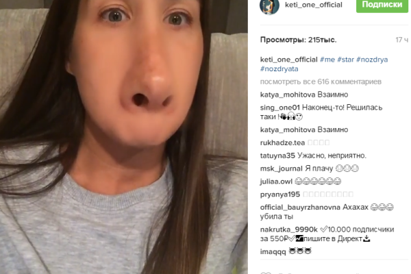 Кэти Топурия после "пластики" осталась без губ