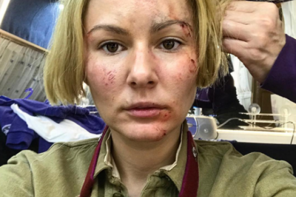 Актриса Мария Кожевникова шокировала снимком с побитым лицом