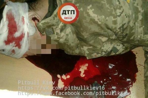 В Киеве произошло шокирующее самоубийство: сотрудник СБУ выстрелил себе в голову, фото (18+)