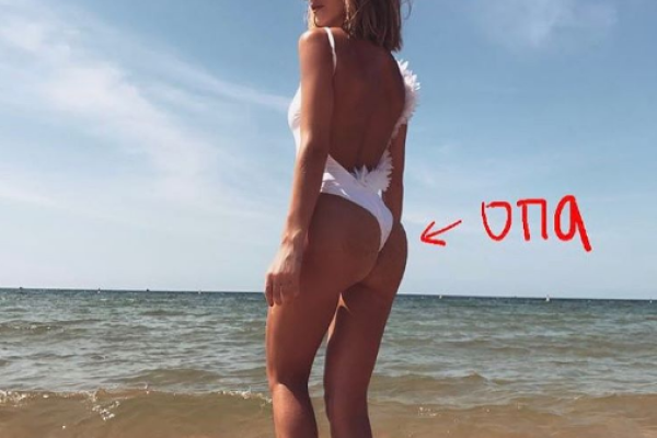 Над Глюкозой посмеялись фанаты: звезда "увеличила" себе пятую точку