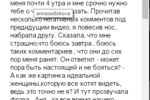Певица Анна Седокова откровенно рассказала о своих недостатках Певица Анна Седокова откровенно рассказала о своих недостатках