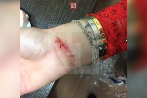 Ольга Бузова получила серьезную травму на концерте: телеведущую спасали медики