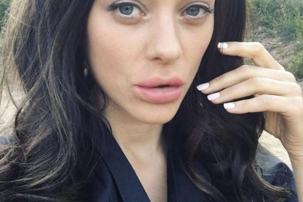 Популярная актриса шокировала фанатов своими губами