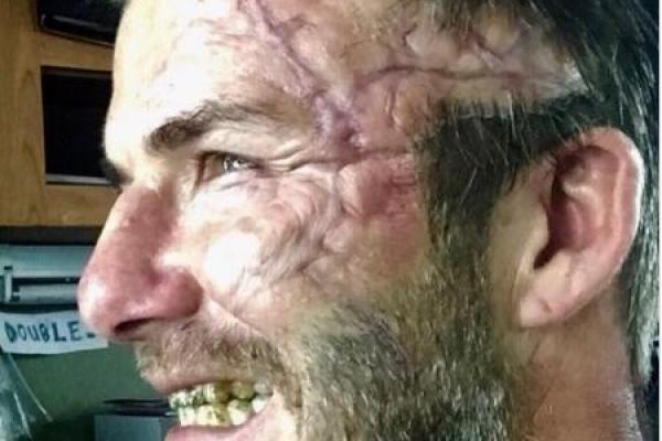 Дэвид Бэкхем шокировал фанаток изуродованным лицом