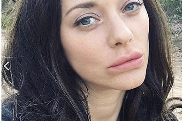 Актриса Марион Котийяр шокировала поклонников результатом неудачной пластической операции
