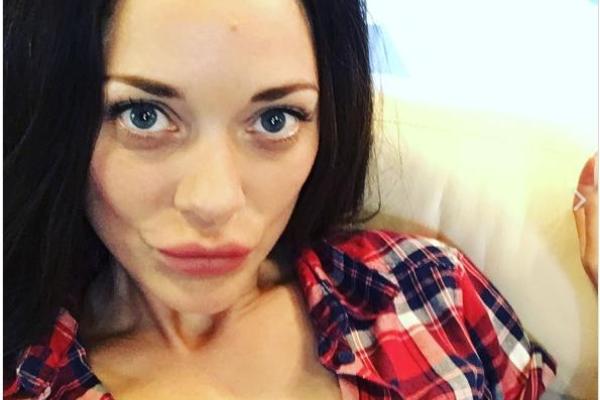 Популярная актриса шокировала фанатов своими губами