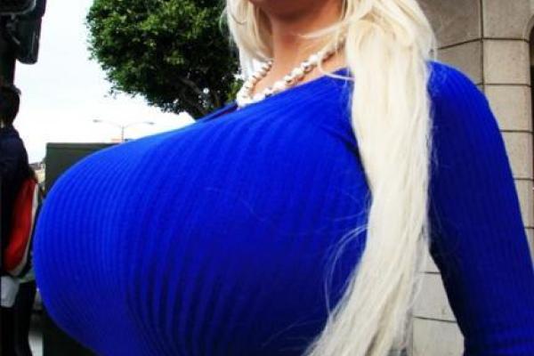 "Шары" 18 размера: изуродованная стюардесса шокировала своей внешностью "Шары" 18 размера: изуродованная стюардесса шокировала своей внешностью