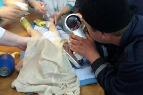 В Одесской области произошел шокирующий инцидент: рука мальчика застряла в соковыжималке