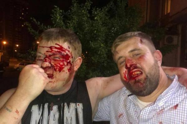 Удар в прямом эфире: российского журналиста в день ВДВ избил не десантник, а драчливый фанат Удар в прямом эфире: российского журналиста в день ВДВ избил не десантник, а драчливый фанат