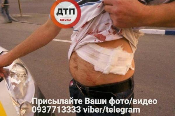 В Киеве мужчину ударили ножом: опубликованы снимки В Киеве мужчину ударили ножом: опубликованы снимки