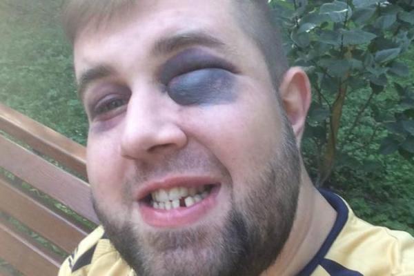 Удар в прямом эфире: российского журналиста в день ВДВ избил не десантник, а драчливый фанат Удар в прямом эфире: российского журналиста в день ВДВ избил не десантник, а драчливый фанат